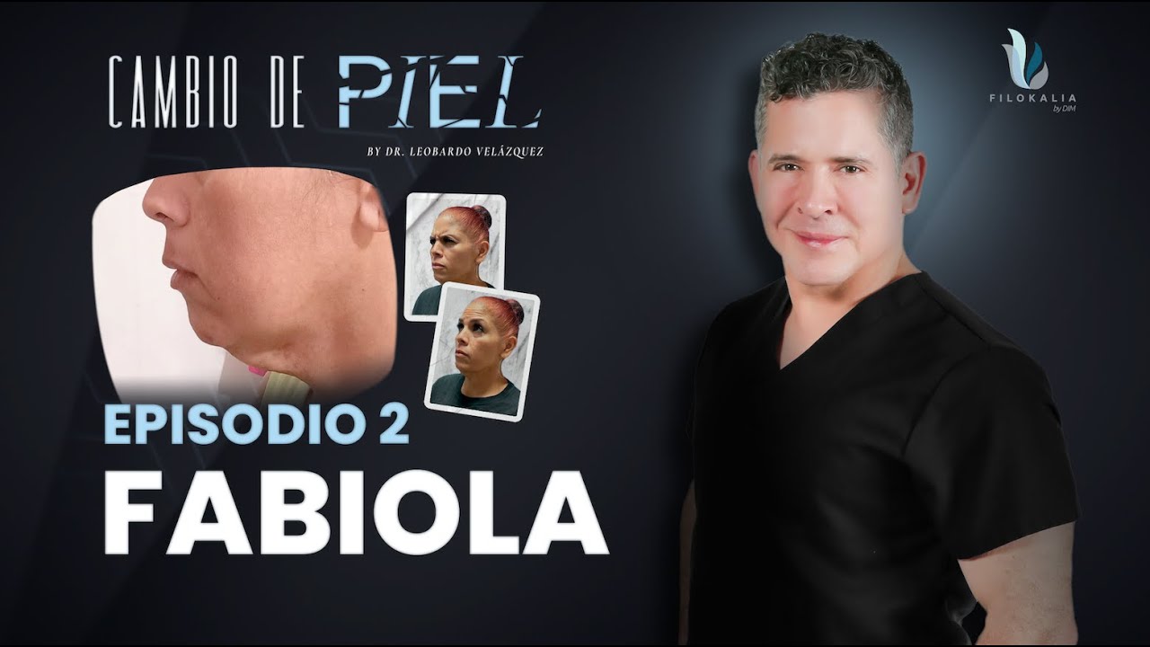 Cambio de Piel - Segundo episodio